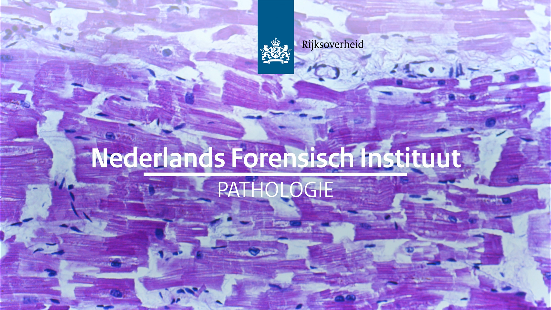 Afbeelding bij video: NFI portretten Pathologie