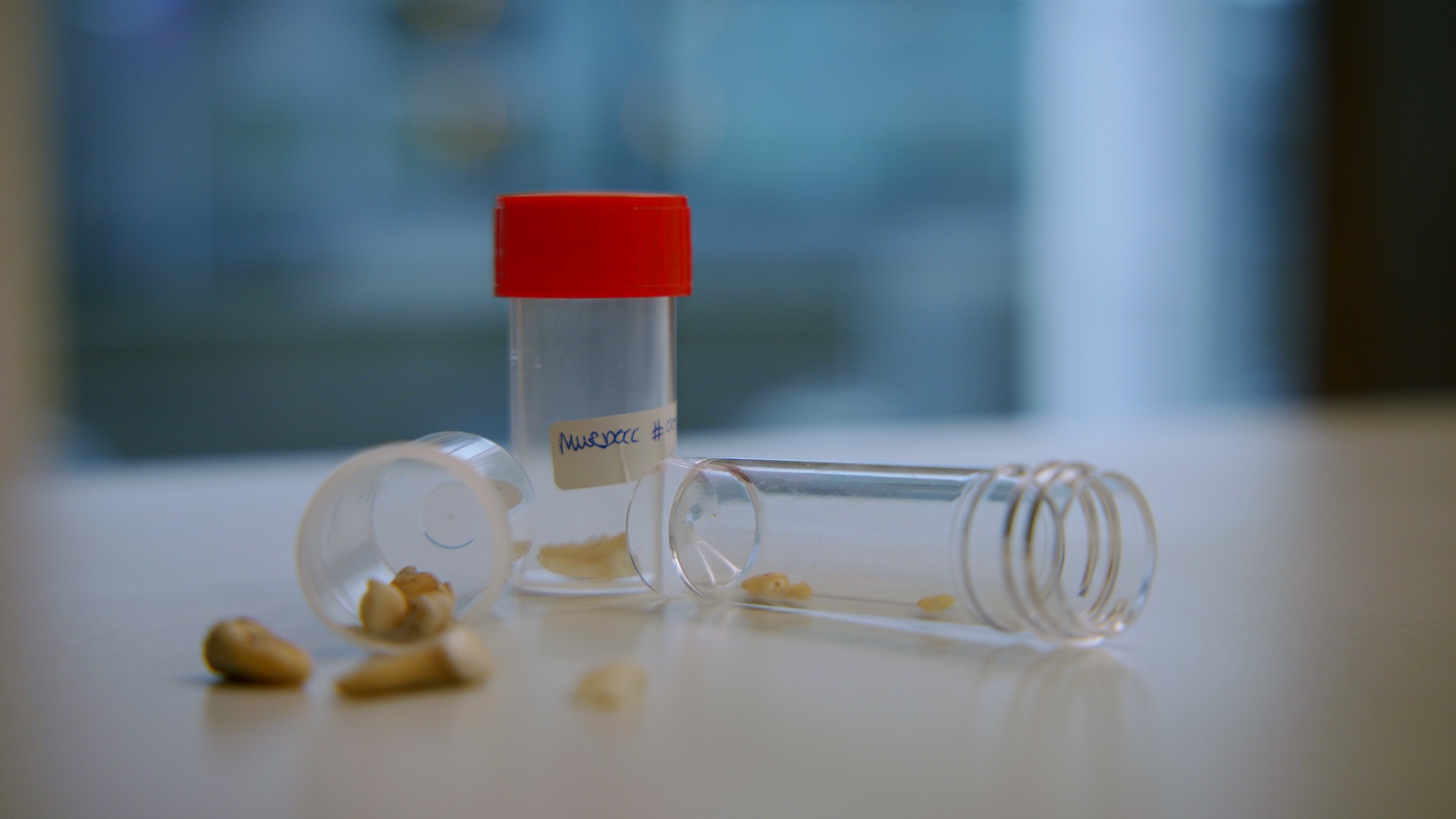 Afbeelding bij video: Tand en nagel ontleed: wat kan het vertellen over onbekende doden?